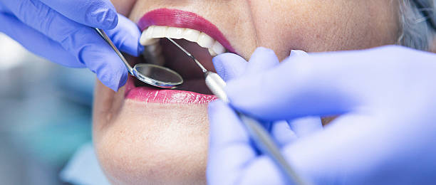 Best Dentist for Tooth Abscess  in Grandwood Park, IL